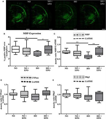 Repetitive Erythropoietin Treatment Improves Long-Term Neurocognitive Outcome by Attenuating Hyperoxia-Induced Hypomyelination in the Developing Brain